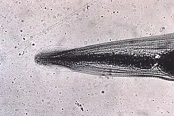 This micrograph reveals the cephalic alae in the head region of E. vermicularis.