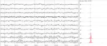 The sample of human EEG with prominent alpha-rhythm in occipital sites