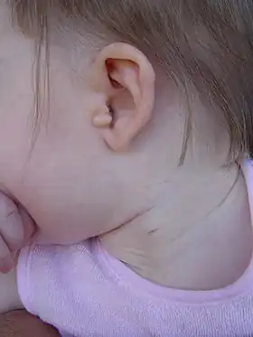 Oreille et cou d'un jeune enfant.