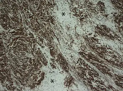 Champ de cellules d'apparence marbrée.