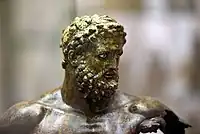 Détail de la tête de l'Hercule de Séleucie du Tigre.