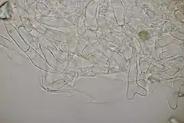 Poils de la face externe de l'apothécie.