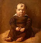 Nain assis inspiré de Vélasquez, école de Goya (début XIXe&nbsp;siècle).