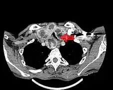 Vue en noir et blanc d'une forme ressemblant à un masque.