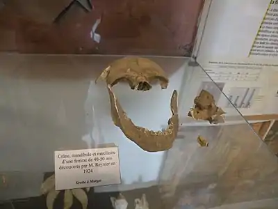 Crâne, mandibule et maxillaire de femme