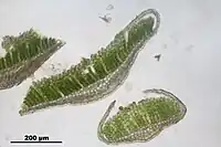 Section transversale de feuilles de Polytrichum juniperinum. On observe la nervure, sur laquelle sont disposées les lamelles. Le limbe, de chaque côté de la nervure est ici rabattu par dessus les lamelles.