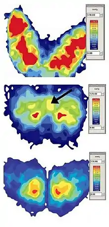 Pression de la position assise