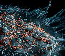 Micrographie électronique à balayage du virus de Lassa se détachant d'une cellule.